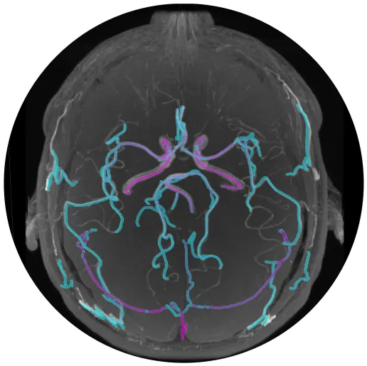 Mātai researchers plot brain health for fresh insights into degenerative conditions